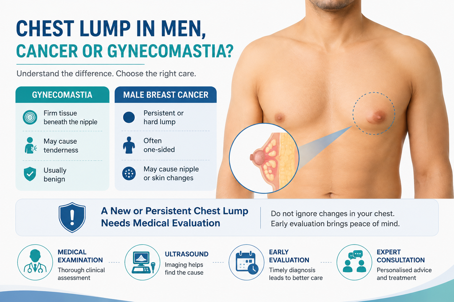 Is a Chest Lump in Men a Sign of Chest Cancer or Gynecomastia?