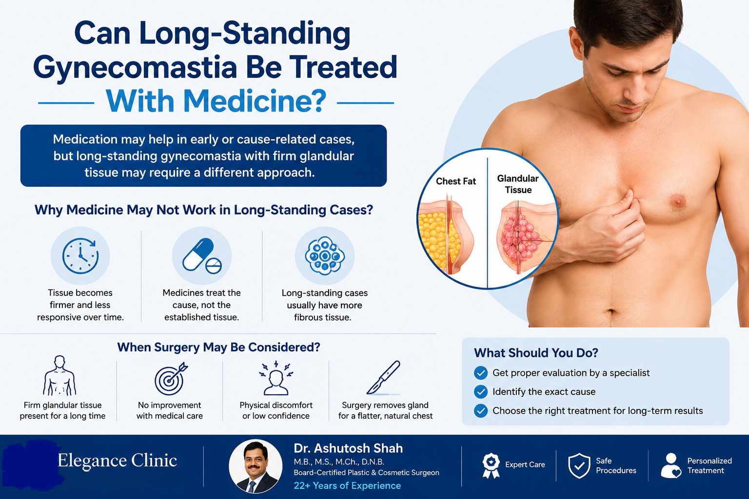 Can Long-Standing Gynecomastia Be Treated With Medicine?