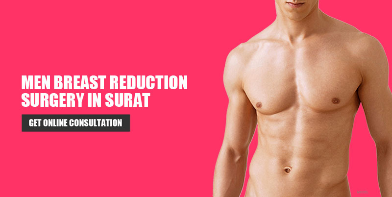 Men Breast Reduction Surgery in Surat