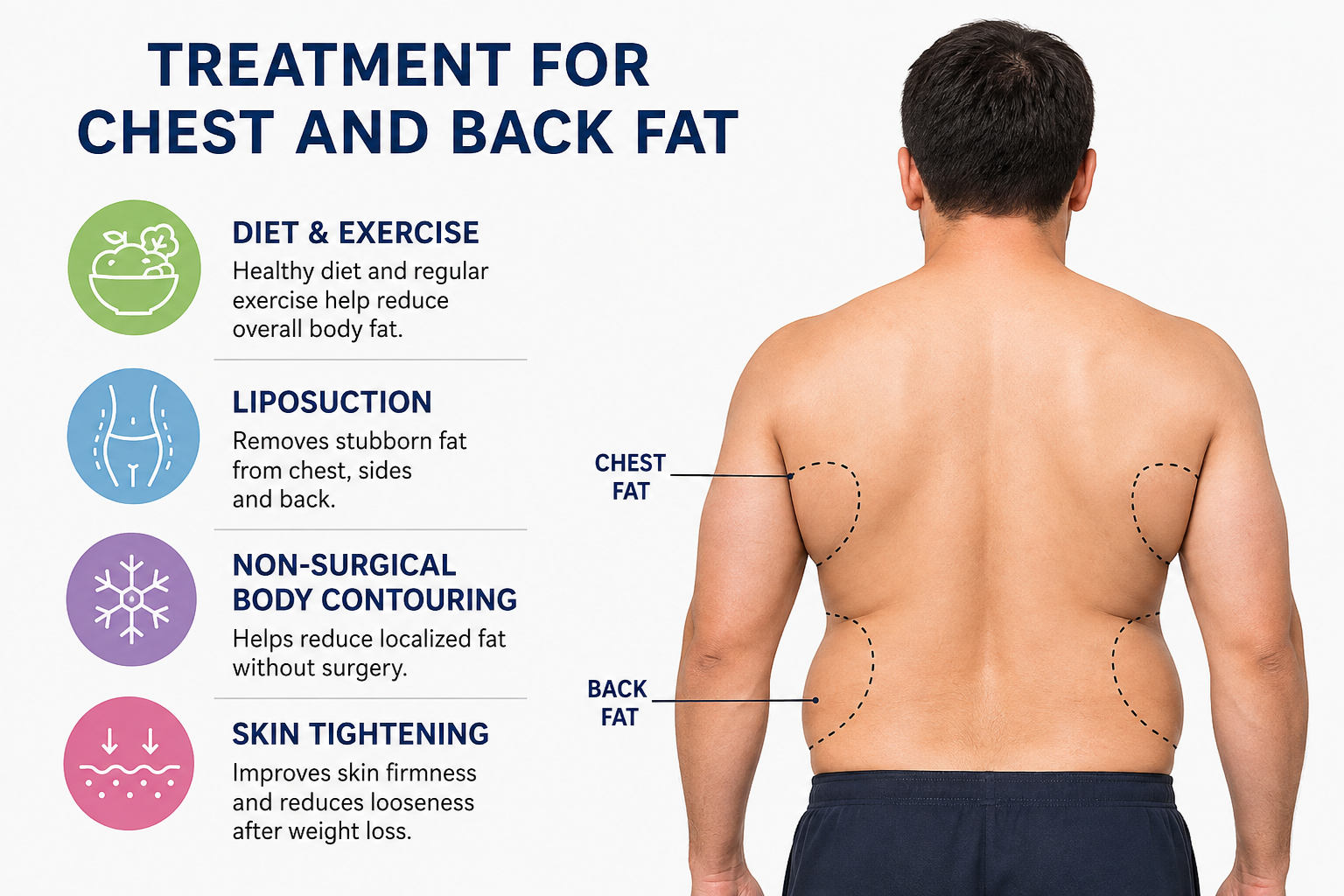 What Is the Best Treatment for Chest and Back Fat?